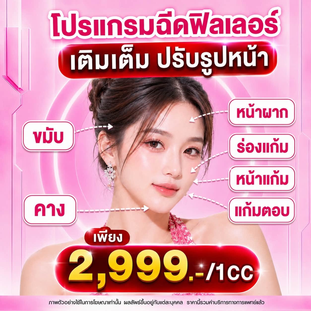 โปรแกรมฉีดฟิลเลอร์ เติมเต็มปรับรูปหน้า 2,999.-/1cc