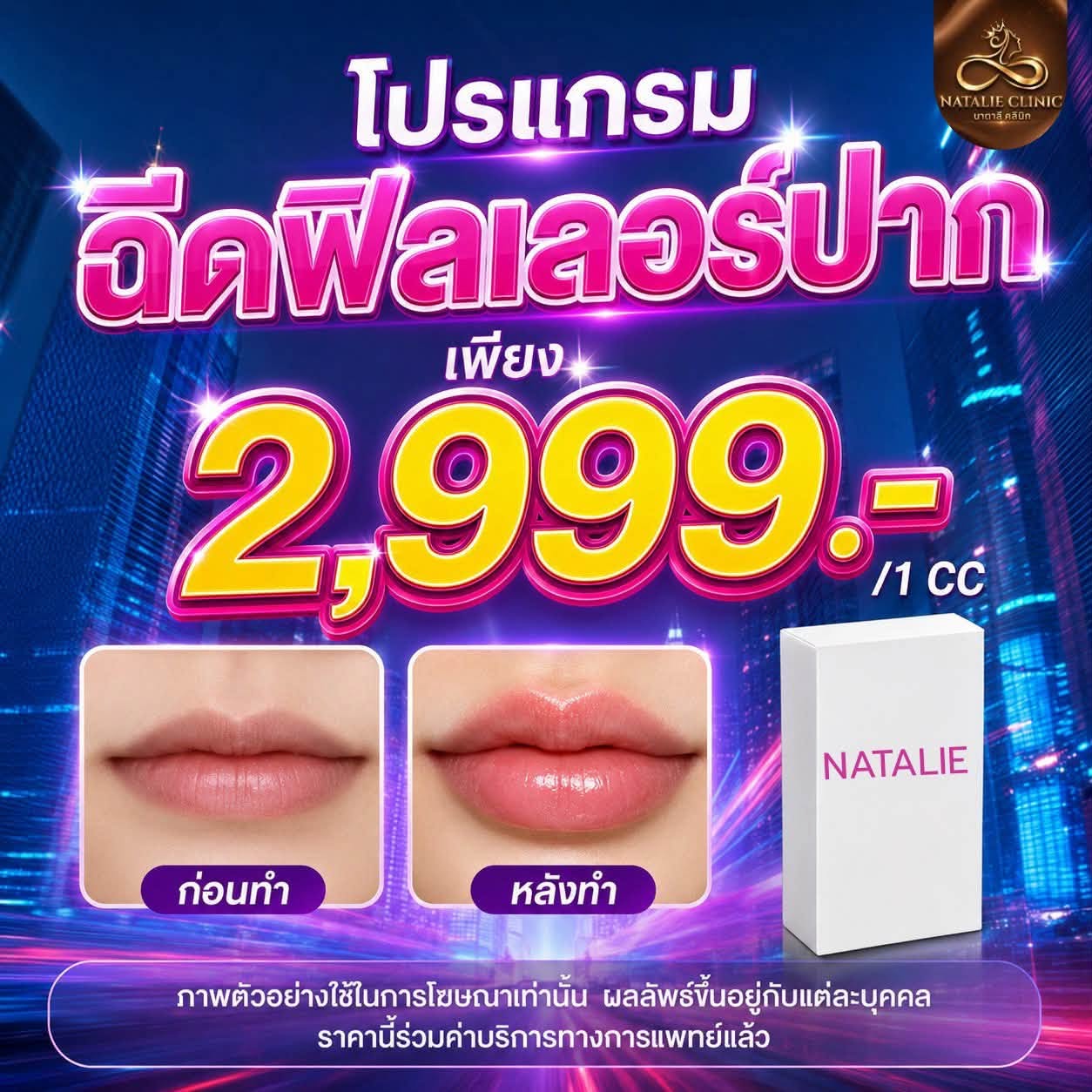 โปรแกรมฉีดฟิลเลอร์ปาก