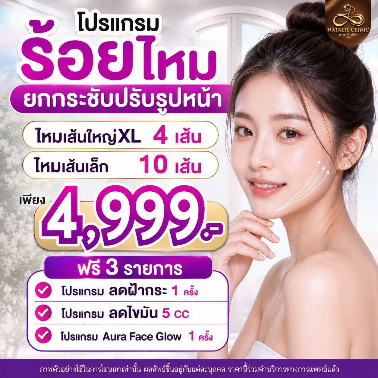 โปรแกรมร้อยไหม ไหมเส้นใหญ่ XL 4 เส้น + ไหมเส้นเล็ก 10 เส้น ฟรี 3 รายการ 4,999.-