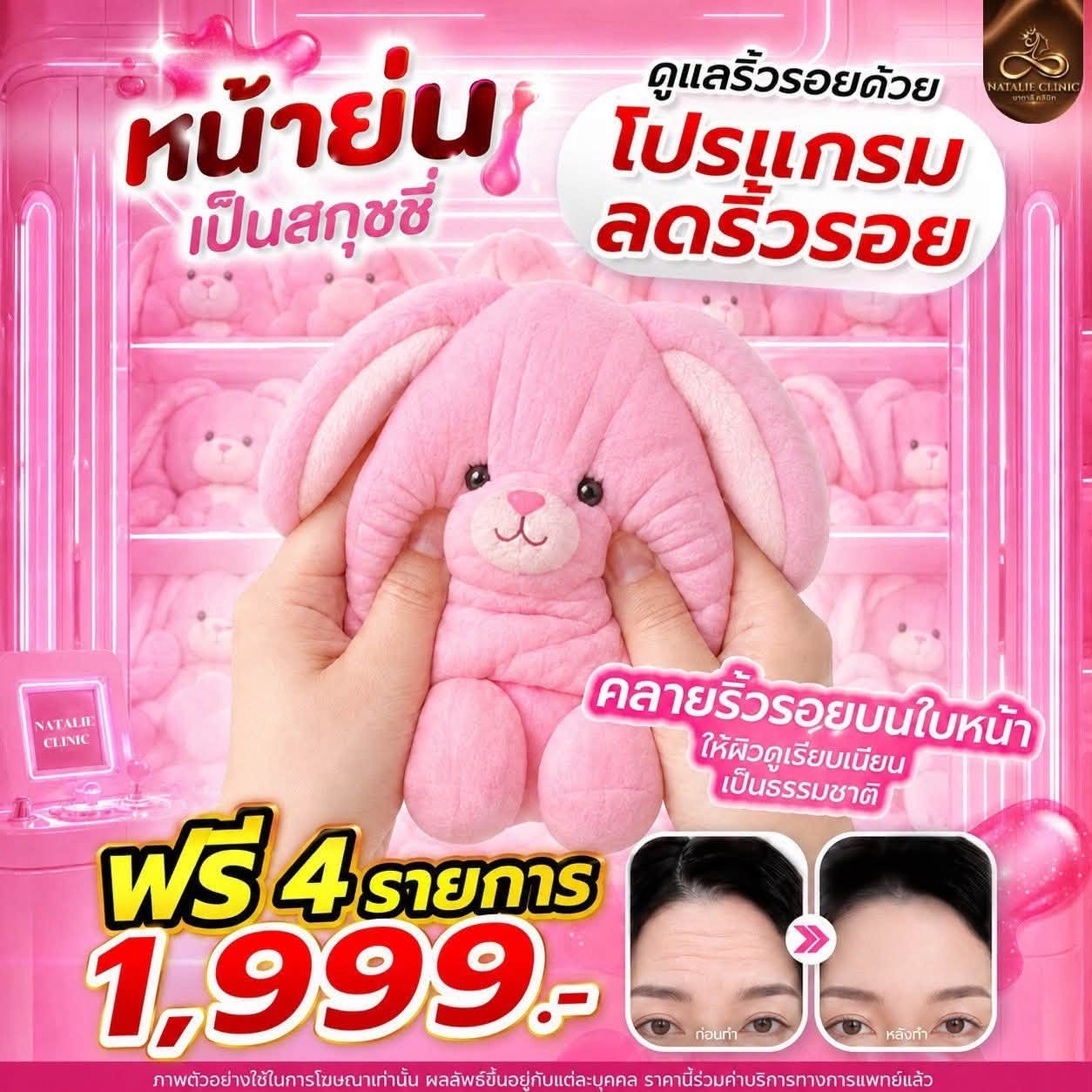 โปรแกรมลดริ้วรอย ฟรี 4 รายการ